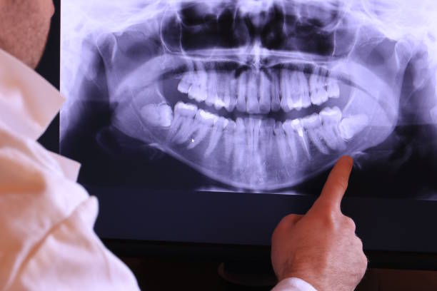 Best Emergency Wisdom Teeth Removal in Montrose Ghent, OH