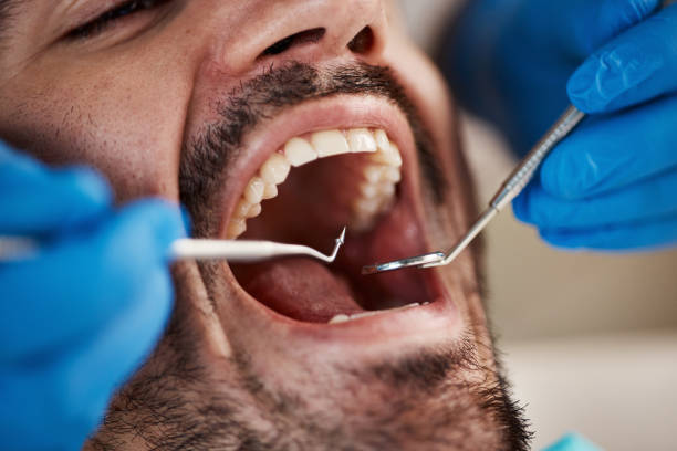 Best Emergency Dental Care for Broken or Chipped Teeth in Montrose Ghent, OH