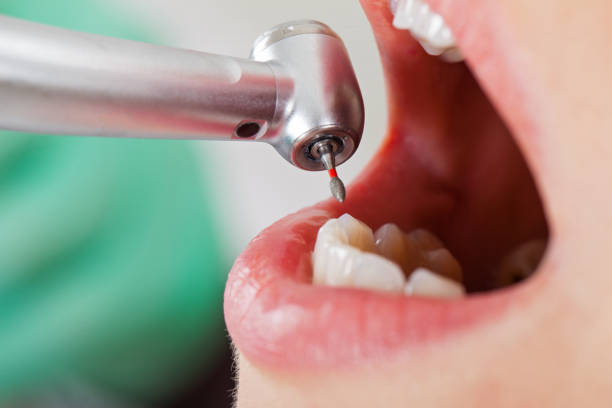 Best Emergency TMJ Treatment in Montrose Ghent, OH